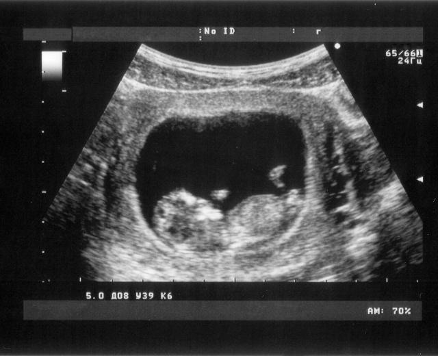 A new comprehensive program at UC Davis Medical Center will soon provide surgical services for unborn children.