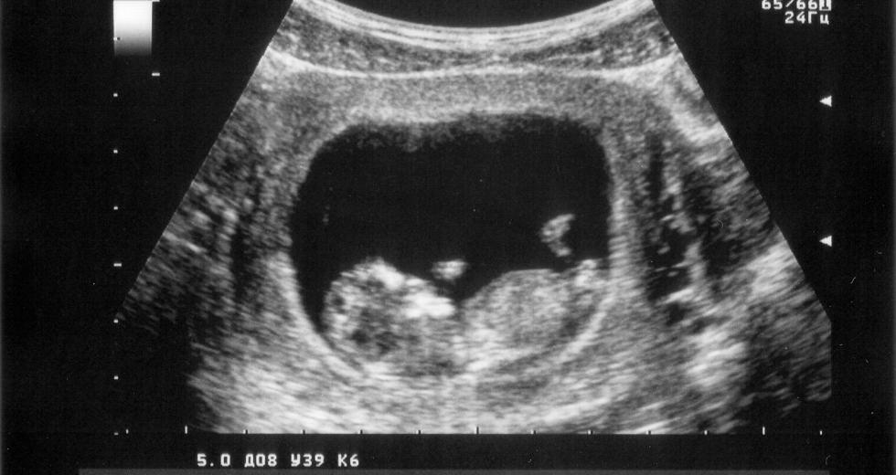 A new comprehensive program at UC Davis Medical Center will soon provide surgical services for unborn children.