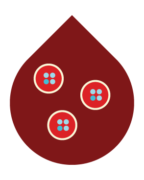 6.) The patient then receives a blood infusion of the genetically modified cells through an IV. Once the stem cells enter the body, they will return to the bone marrow and begin to regenerate an HIV-free immune system. HIV can sometimes remain hidden in areas of the body, such as the lymph nodes, but facing a resistant immune system, the virus should not be able to replicate.