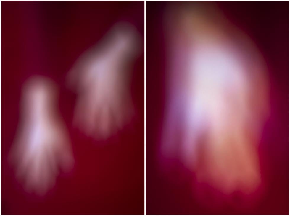 After suffering a stroke in his right eye in 2012, Winter, a trained commercial photographer, began to think differently about sight and perception.The title of this image is “Full of Grace.”